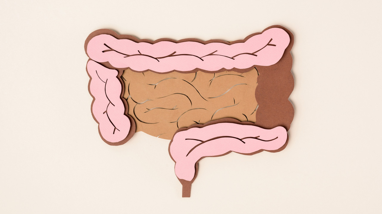 Como entender melhor Colite Ulcerosa?